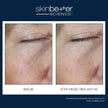 Skinbetter Science - Instant Effect Eye Gel