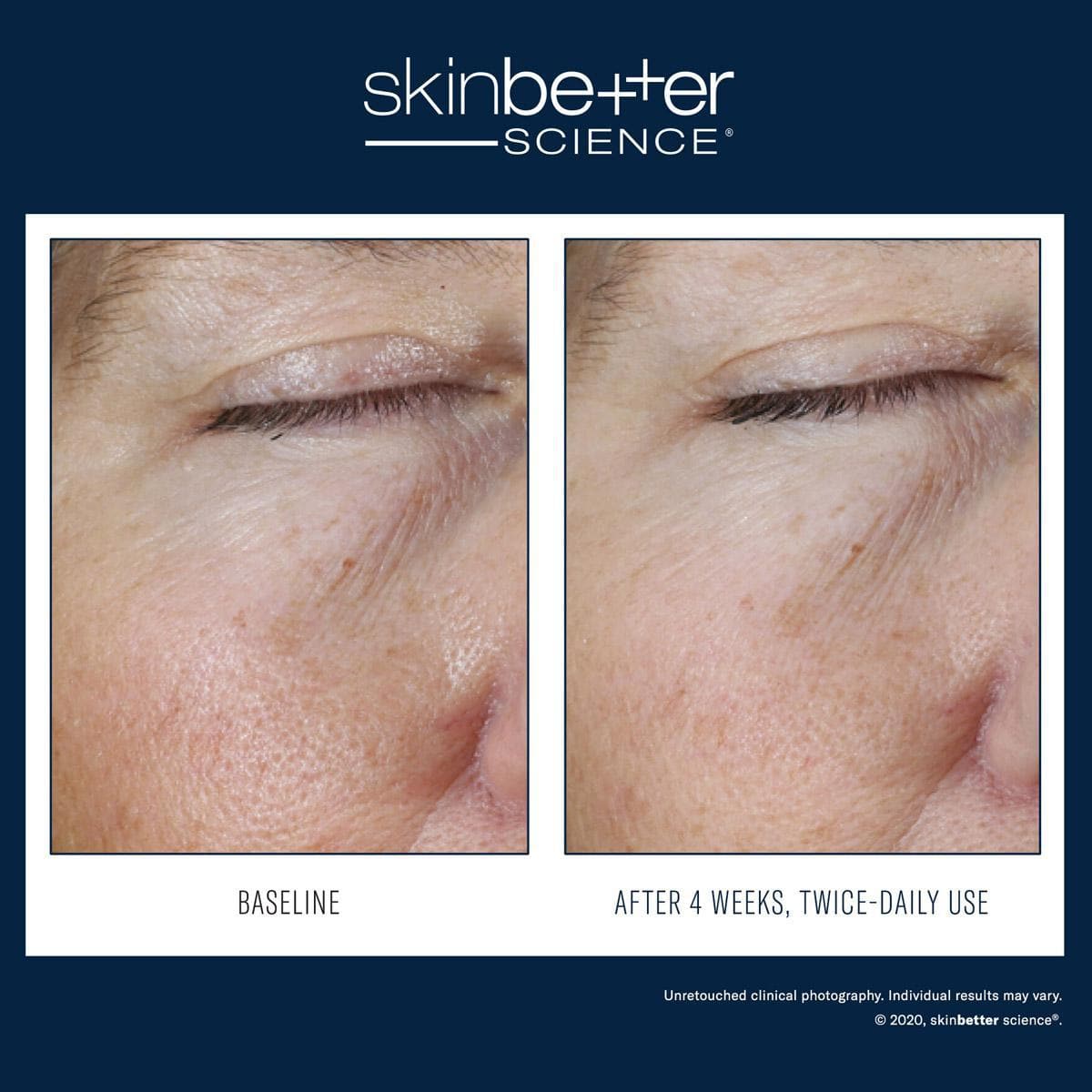 Skinbetter Science - Instant Effect Eye Gel