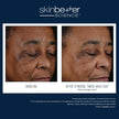 Skinbetter Science - Mystro Active Balance Serum