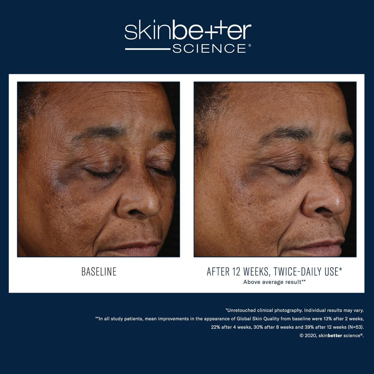 Skinbetter Science - Mystro Active Balance Serum