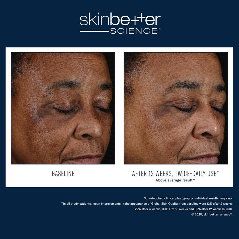 Skinbetter Science - Mystro Active Balance Serum