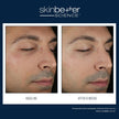 Skinbetter Science - Solo Hydrating Defense