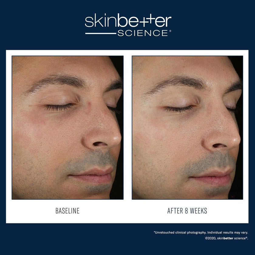 Skinbetter Science - Solo Hydrating Defense