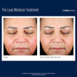 SkinBetter Science - Trio Luxe Moisture Treatment