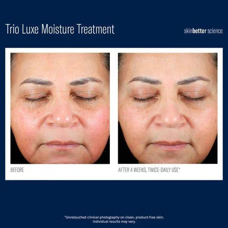 SkinBetter Science - Trio Luxe Moisture Treatment