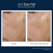 Skinbetter Science - Trio Rebalancing Moisture Treatment