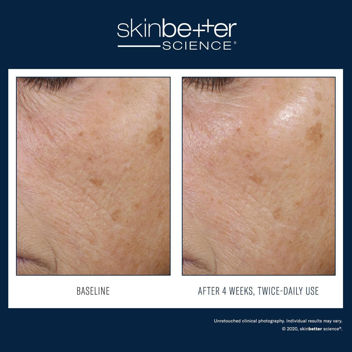 Skinbetter Science - Trio Rebalancing Moisture Treatment