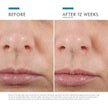 SkinCeuticals H.A. Intensifier