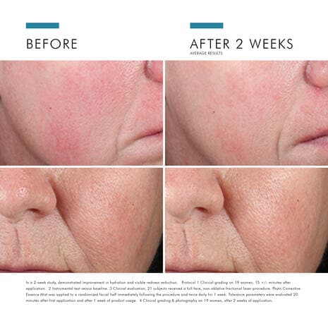 SkinCeuticals Phyto Corrective Essence Mist
