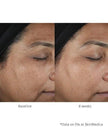 SkinMedica Lumivive™ System Day+Night