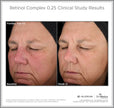 SkinMedica Retinol Complex