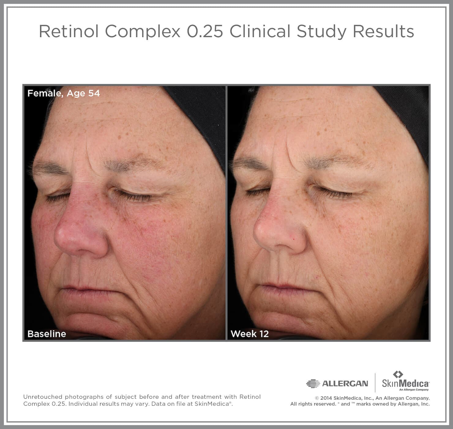 SkinMedica Retinol Complex