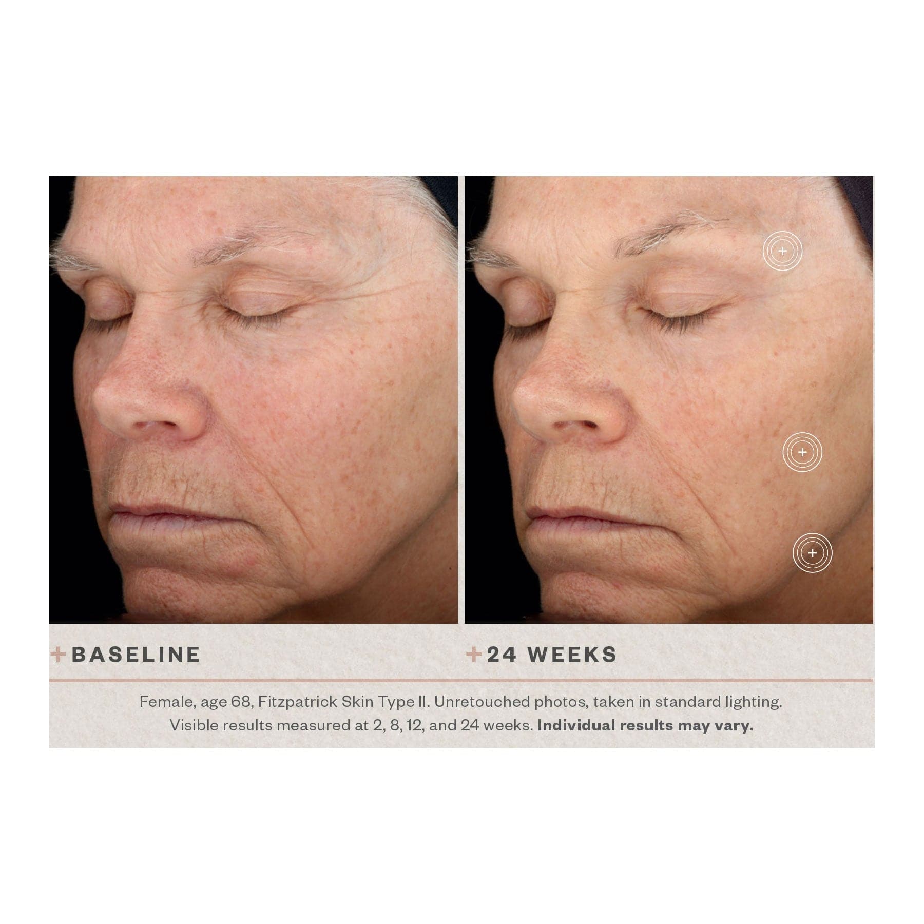 SkinMedica TNS Advanced+ Serum