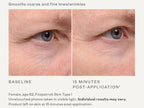 SkinMedica TNS Eye Repair