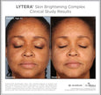 SkinMedica®Lytera 2.0