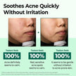 SOME BY MI AHA BHA PHA 30 Days Miracle Toner 150ml