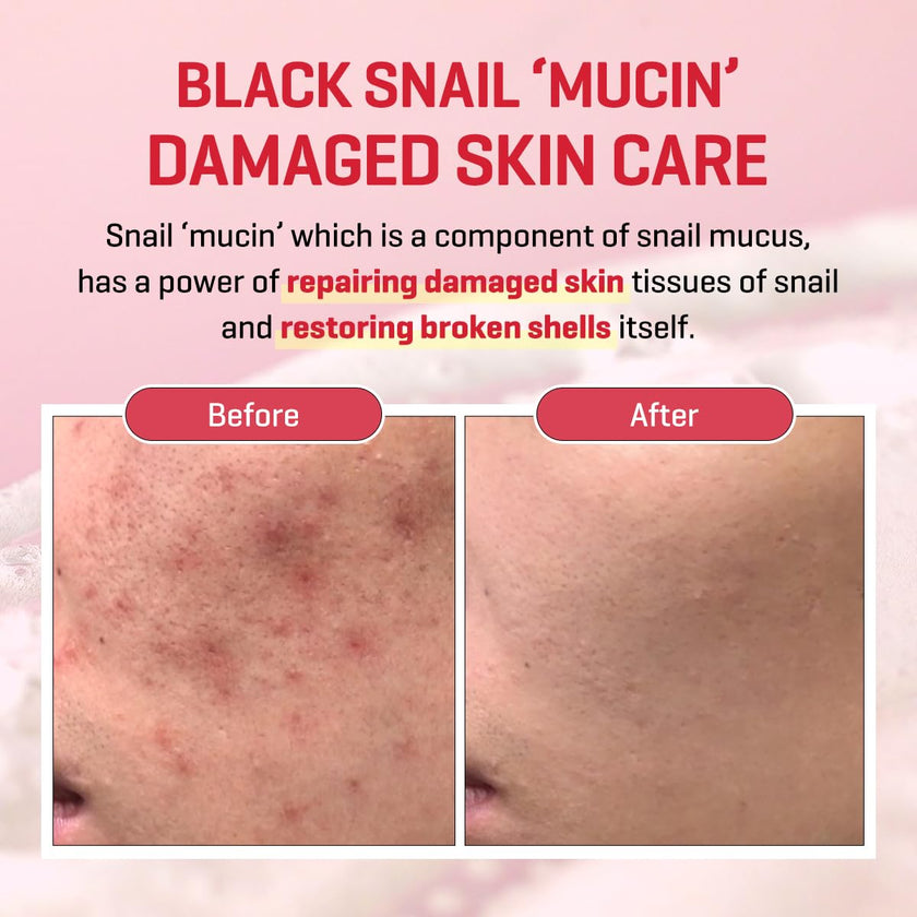 SOME BY MI Snail Truecica Miracle Serum 50ml