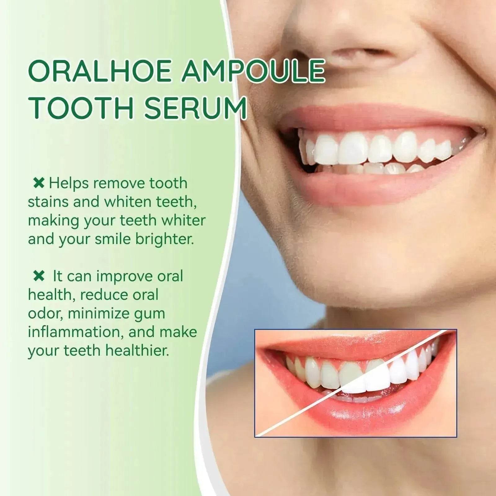 Teeth Whitening Liquid Deep Cleaning