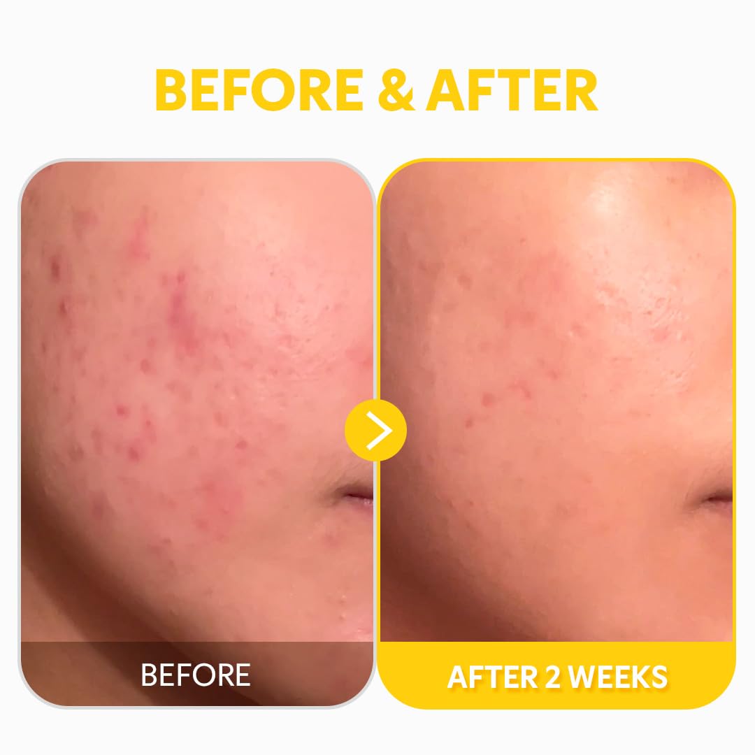 TIRTIR Pure Vitamin C 24 Serum 30ml