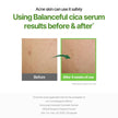 Torriden Balanceful Cica Serum 10ml