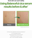 Torriden Balanceful Cica Serum 50ml