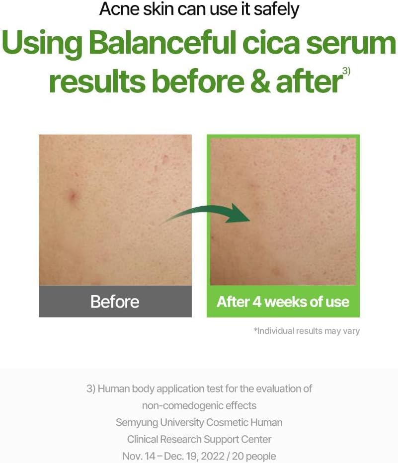 Torriden Balanceful Cica Serum 50ml