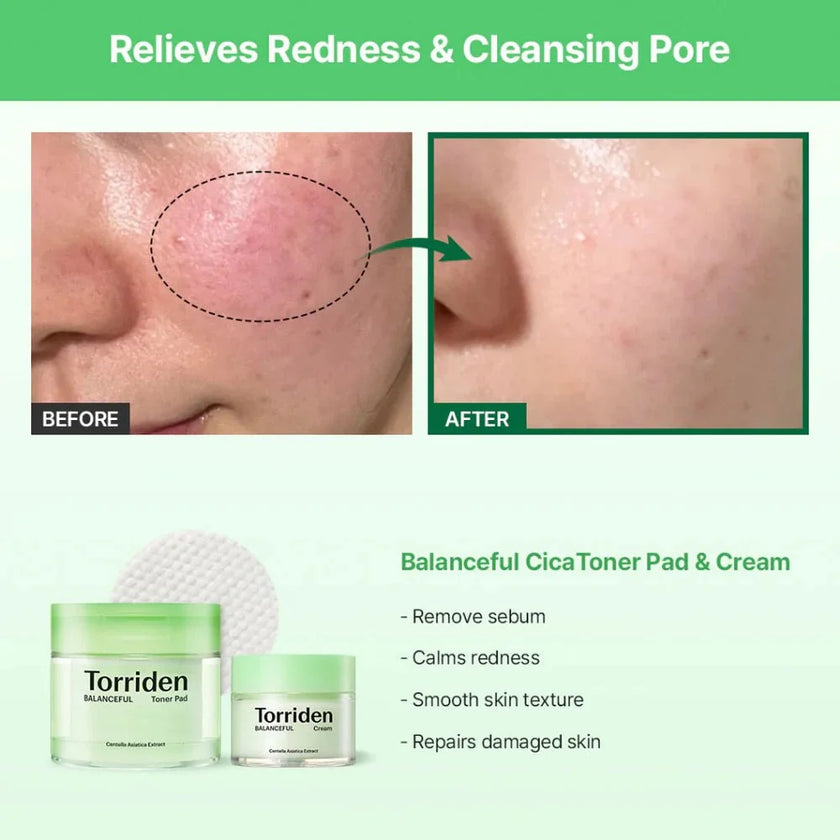Torriden Balanceful Cica Toner Pad 180ml / 60pads