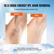 VEVOR Laser Hair Removal, IPL Permanent Hair Removal with Ice Cooling System for Women Men, Auto/Manual Modes & 5 Levels, Painless At-Home Hair Removal Device for Legs, Arms, Armpits, Bikini Line