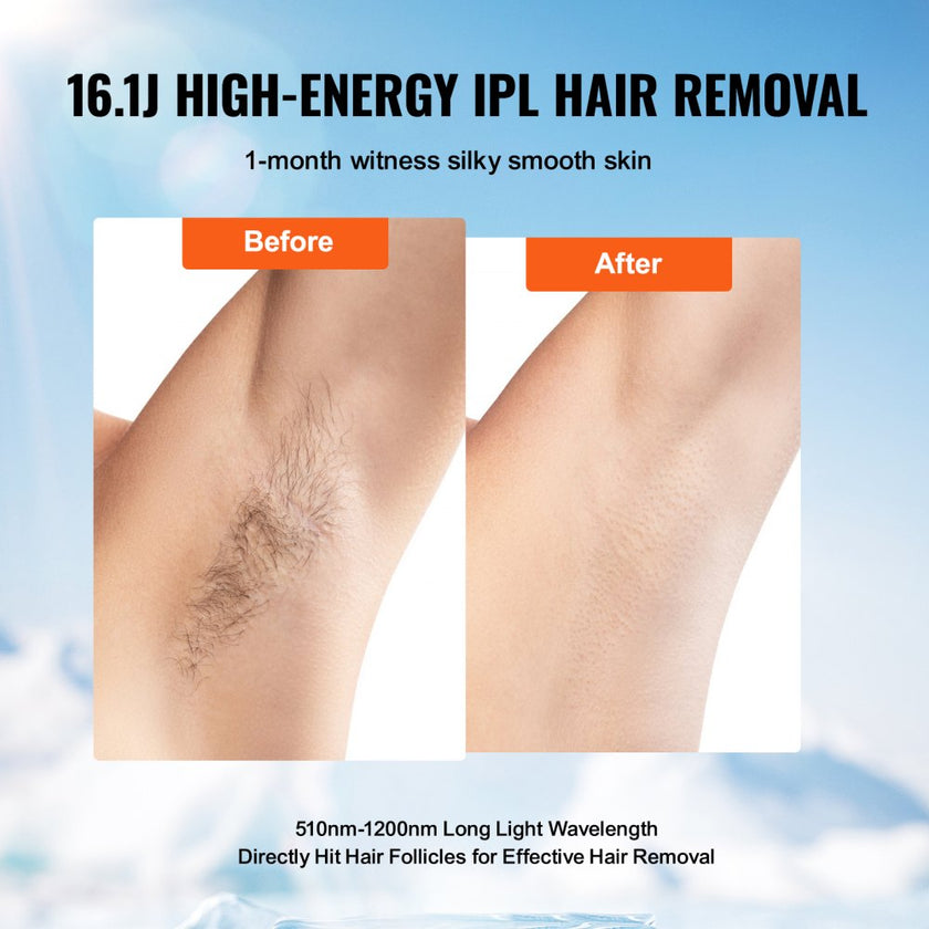 VEVOR Laser Hair Removal, IPL Permanent Hair Removal with Ice Cooling System for Women Men, Auto/Manual Modes & 5 Levels, Painless At-Home Hair Removal Device for Legs, Arms, Armpits, Bikini Line