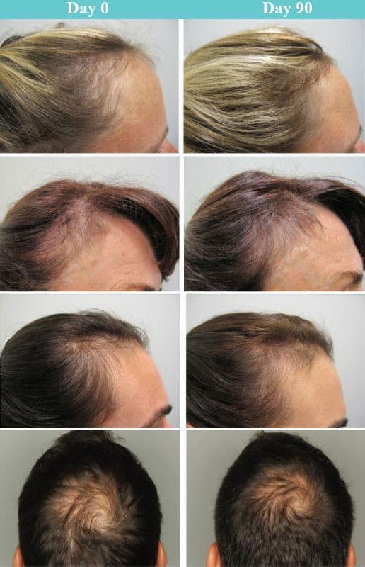 Viviscal Professional Vitamins