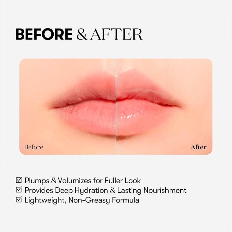 VT Reedle Shot Lip Plumper 4ml - Beginner