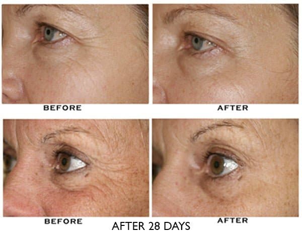 ZO Growth Factor Serum Eye