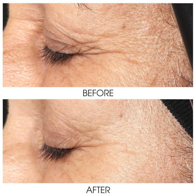 ZO Growth Factor Serum Eye