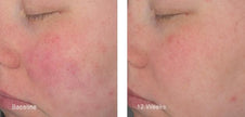 ZO Hydrating Creme