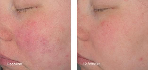 ZO Hydrating Creme