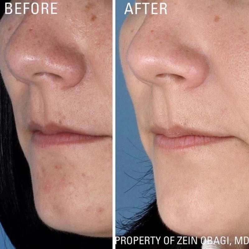 ZO Instant Pore Refiner