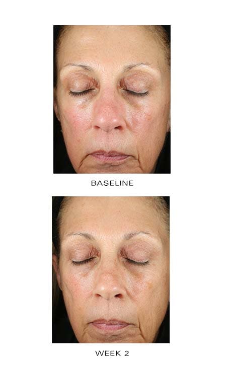 ZO Renewal Creme
