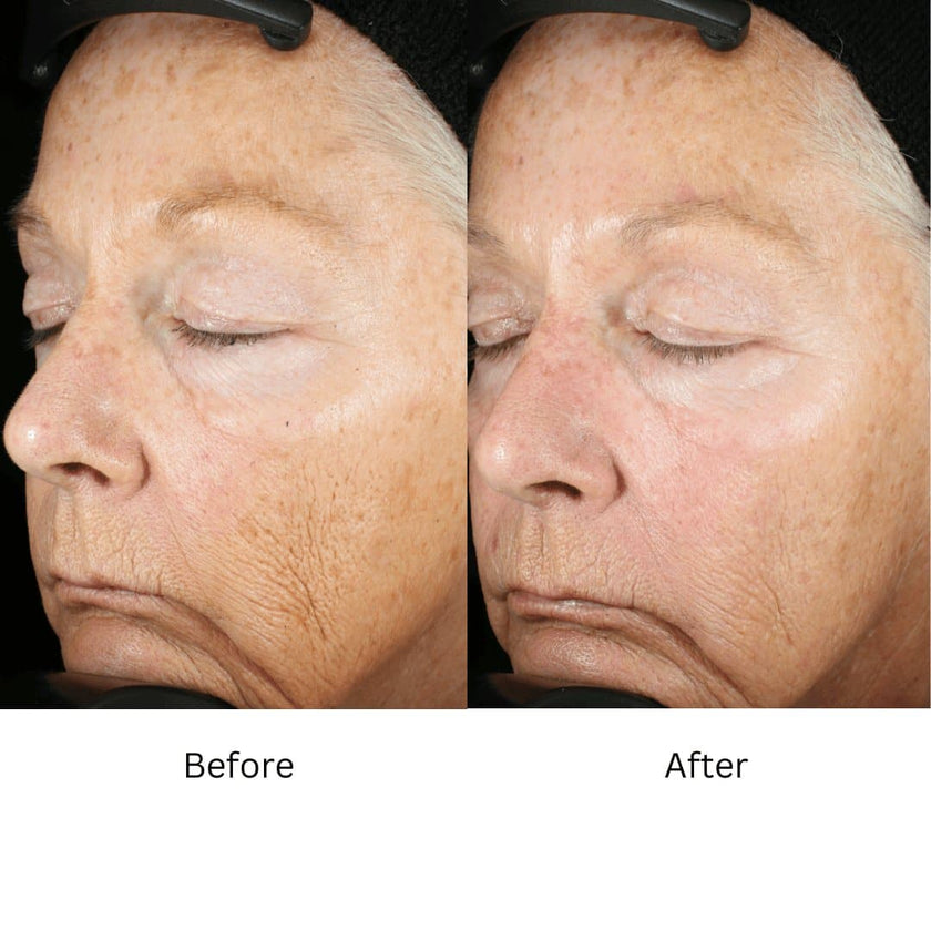 ZO Wrinkle and Texture Repair (Travel Size)